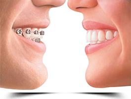 Orthodontics Dental Care